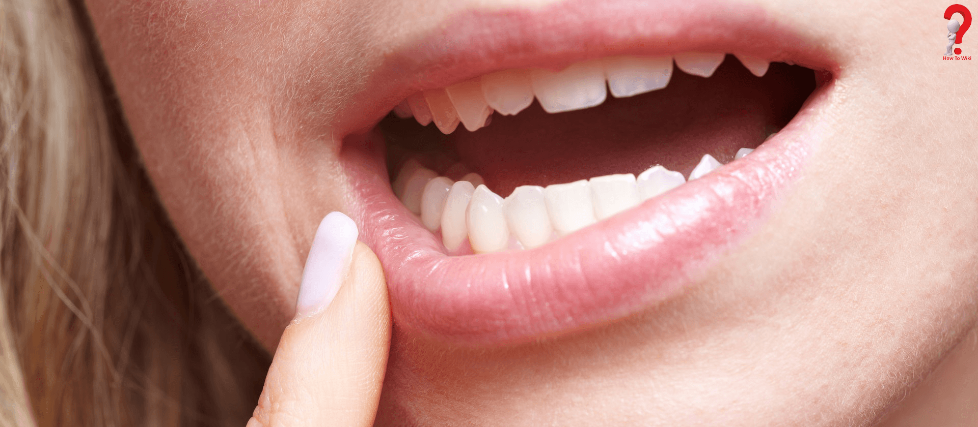 Reduce Lip swelling